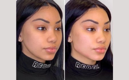 The Science Behind the Thread Lift in Dubai: How It Actually Works