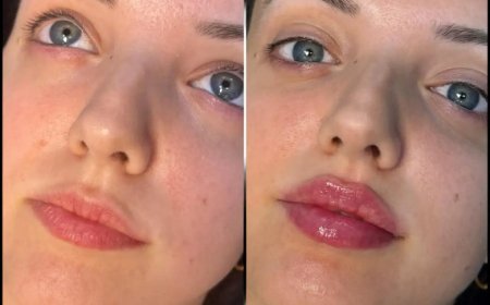 Best Plastic Surgeons in Dubai for Creating Harmonious and Balanced Facial Features with Fillers