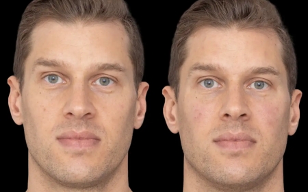 Best Plastic Surgeons in Dubai for Jawline Enhancement: The Power of Fillers
