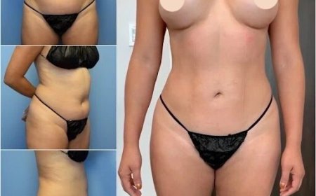 Sculpt Your Ideal Body Shape with the Best Body Contouring Surgeon in Dubai