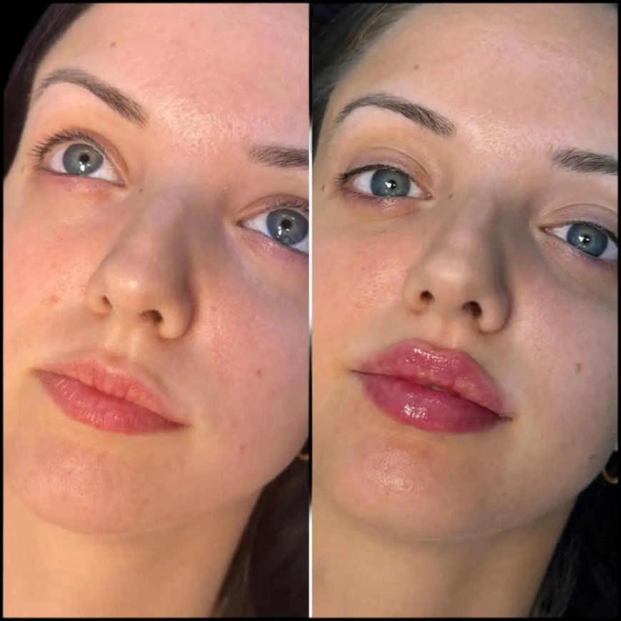 Best Plastic Surgeons in Dubai for Creating Harmonious and Balanced Facial Features with Fillers