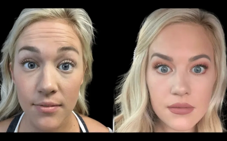 Your First Visit to the Best Aesthetic Clinic in Dubai – What to Expect