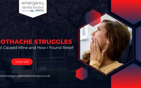 Toothache Struggles: What Caused Mine and How I Found Relief