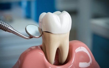Dental Crowns for Both Cosmetic and Functional Fix