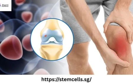 Healing Beyond Recovery: The Power of Stem Cell Therapy Singapore for Joints and cardic Therapy