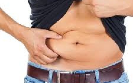 Liposuction in Islamabad – The Smart Choice for Body Contouring