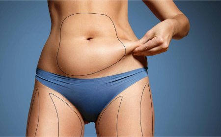 How to Choose the Best Clinic for Abdominoplasty in Dubai: What to Look For