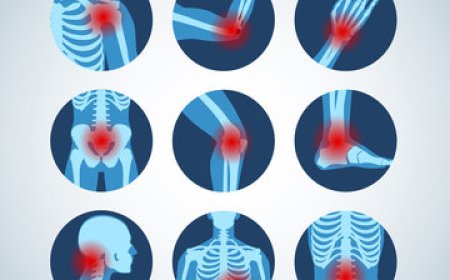 Celebrex 200mg – Pain Relief & How It Works