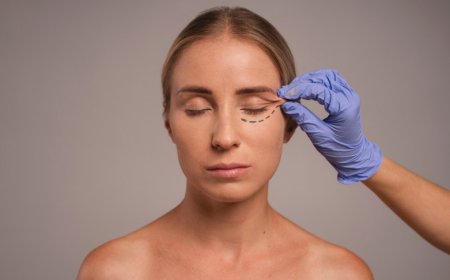 SMAS Lift The Ultimate Solution for Natural, Long Lasting Facial Rejuvenation