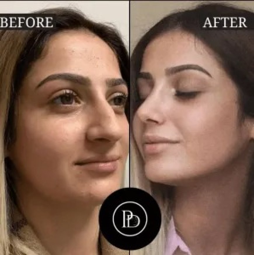 Perfectdrs Helped Me Look 10 Years Younger – Best Aesthetic Clinic in Dubai