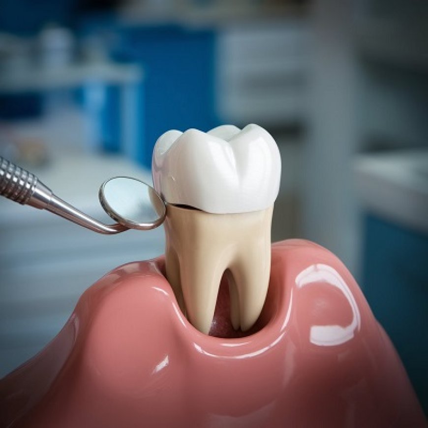 Dental Crowns for Both Cosmetic and Functional Fix