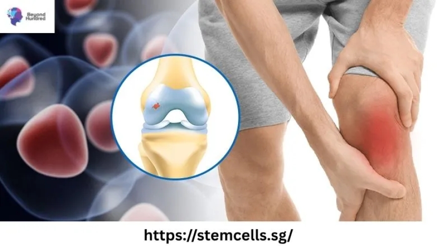 Healing Beyond Recovery: The Power of Stem Cell Therapy Singapore for Joints and cardic Therapy