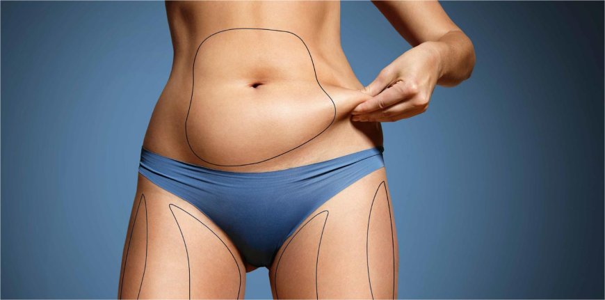 How to Choose the Best Clinic for Abdominoplasty in Dubai: What to Look For