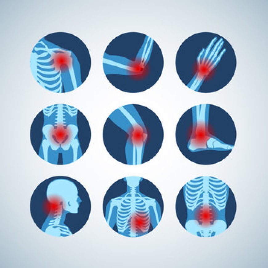 Celebrex 200mg – Pain Relief & How It Works