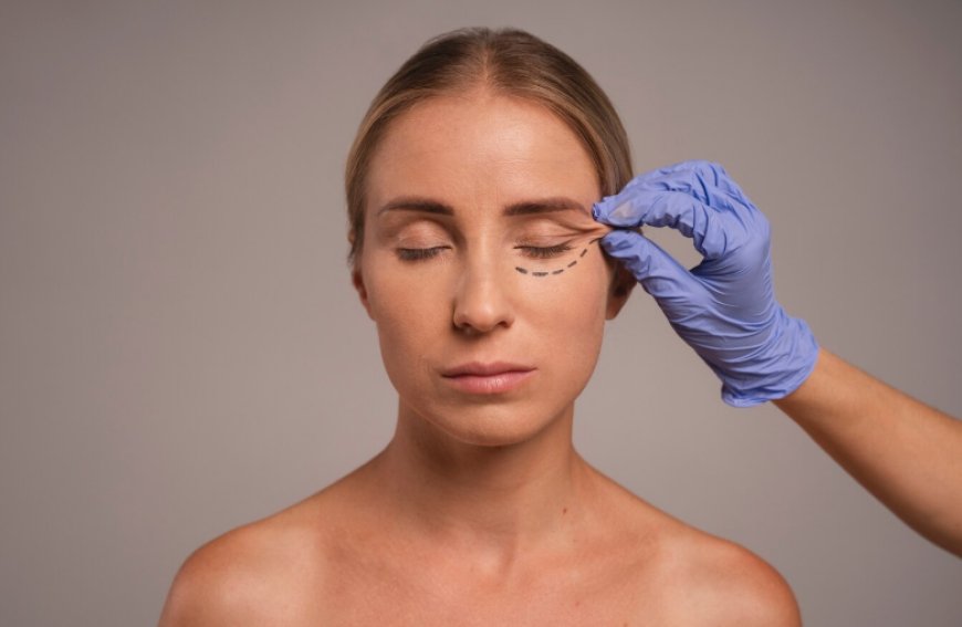 SMAS Lift The Ultimate Solution for Natural, Long Lasting Facial Rejuvenation