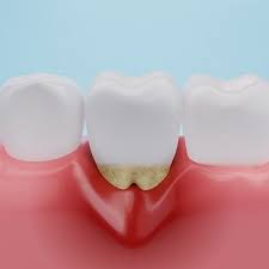 Root Canal Treatment Cost: What to Expect and How to Budget
